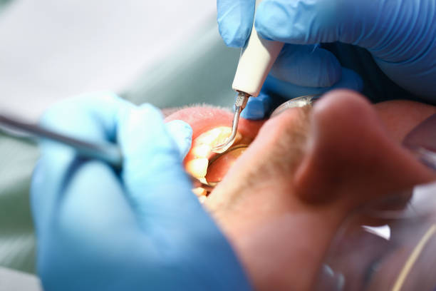  West Canton, NC Emergency Dentist Pros