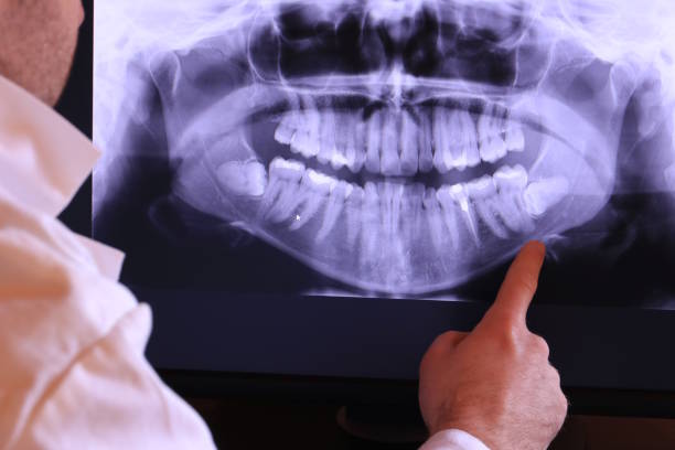 Best Emergency Root Canal Treatment in West Canton, NC