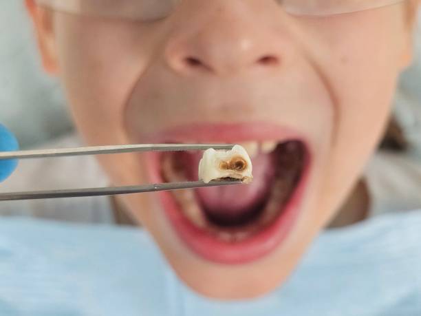 Best Pediatric Emergency Dentist in West Canton, NC