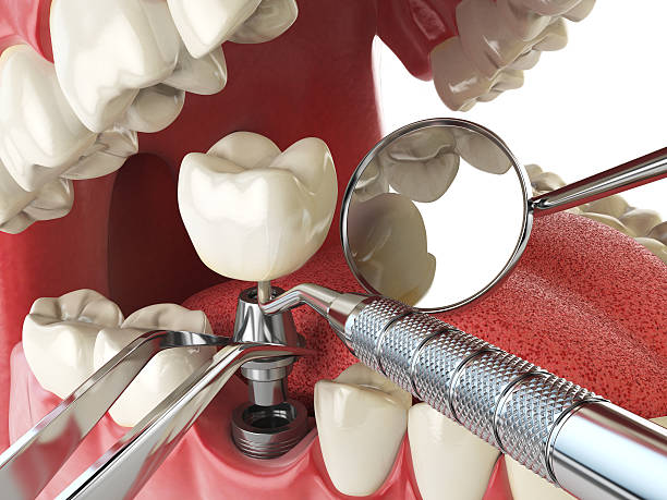Best Emergency Treatment for Toothache in West Canton, NC